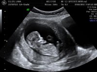 JAN 4, 2011_1.jpg