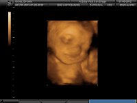 BABY_32.jpg