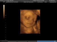 BABY_31.jpg