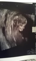 12wks1dayprofile.jpg