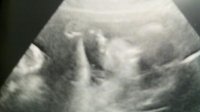 ultrasound26w2d_babyface.jpg