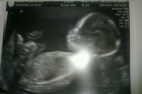 baby.jpg