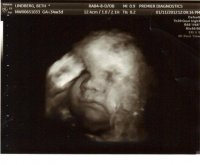 34weeks.JPG