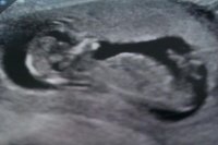 IMG-20120112-WA0000.jpg