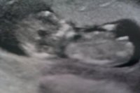 IMG-20120112-WA0001.jpg