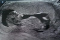 IMG-20120112-WA0002.jpg