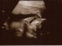 20weeks3.jpg