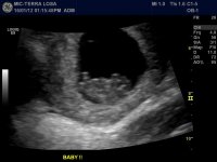 9 week ultrasound.jpg