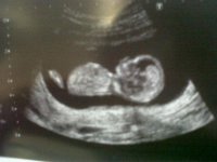 13 weeks.jpg