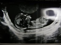 12w5d 2.jpg