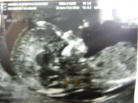 12w5d 9.jpg