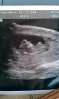 ultrasound1.jpg