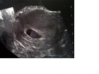7 week ultrasound.jpg