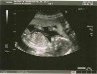 baby20-wks.jpg