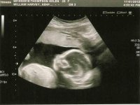baby21+5.jpg