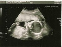 baby21+5-pic2.jpg