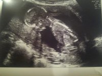 14weeks.jpg