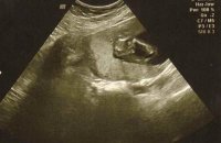 gender scan.jpg