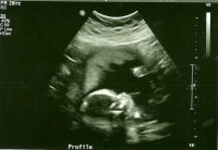 Doyle 20 weeks 2.jpg