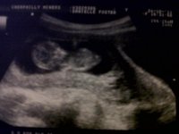 12 weeks scan.jpg