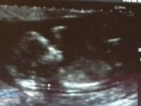 baby 2 pic 3.jpg