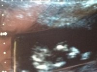 baby 2 pic 2.jpg