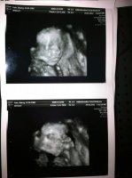 21 WEEK ULTRASOUND 3.jpg