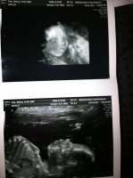21 WEEK ULTRASOUND.jpg