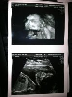21 WEEK ULTRASOUND 2.jpg