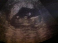 baby222.jpg