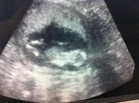 baby22222.jpg