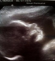 23 weeks 5 days.jpg