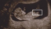 Girl scan.jpg