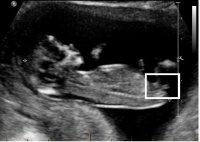 My scan.jpg