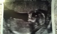 14wks3days.jpg