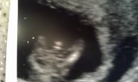 14wks3daysboy?.jpg