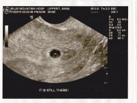 ultrasound1picture.jpg