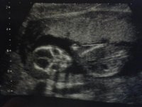 Scan.jpg