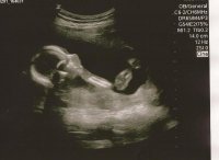 19weeksUltrasound.jpg