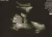 19WeeksUltrasoundc.jpg