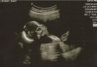 19WeeksUltrasoundd.jpg