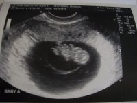 baby a 8 weeks 6 days.jpg