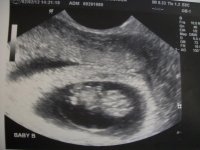 baby b 8 weeks 6 days.jpg