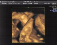 Baby1009.jpg