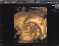 Baby1010.jpg