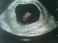 baby 7w3d.jpg