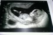 13 week scan.jpg