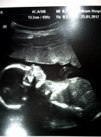 20 wk scan.jpg