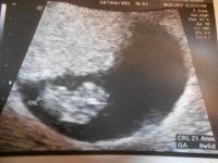 bellybean!.jpg