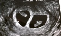 babies 7w5d.jpg